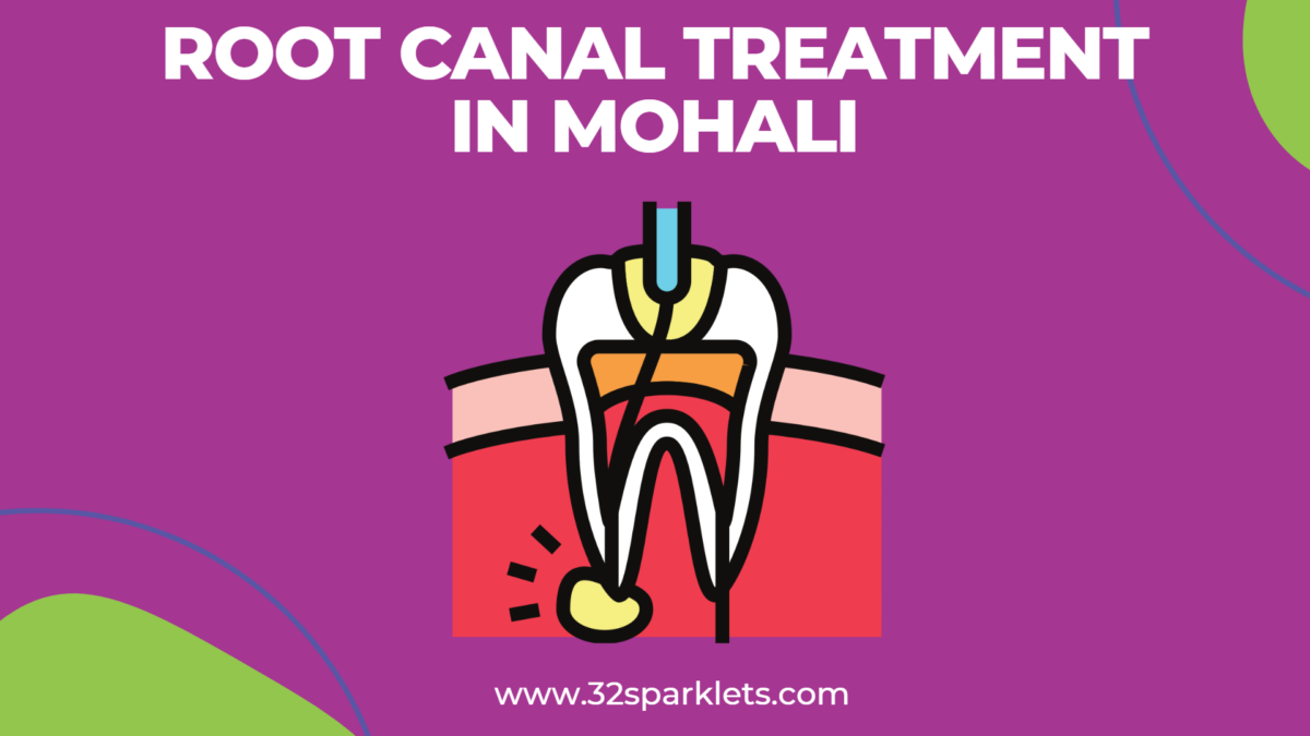 Painless Root Canal Treatment in Mohali & Chandigarh 32 Sparklets