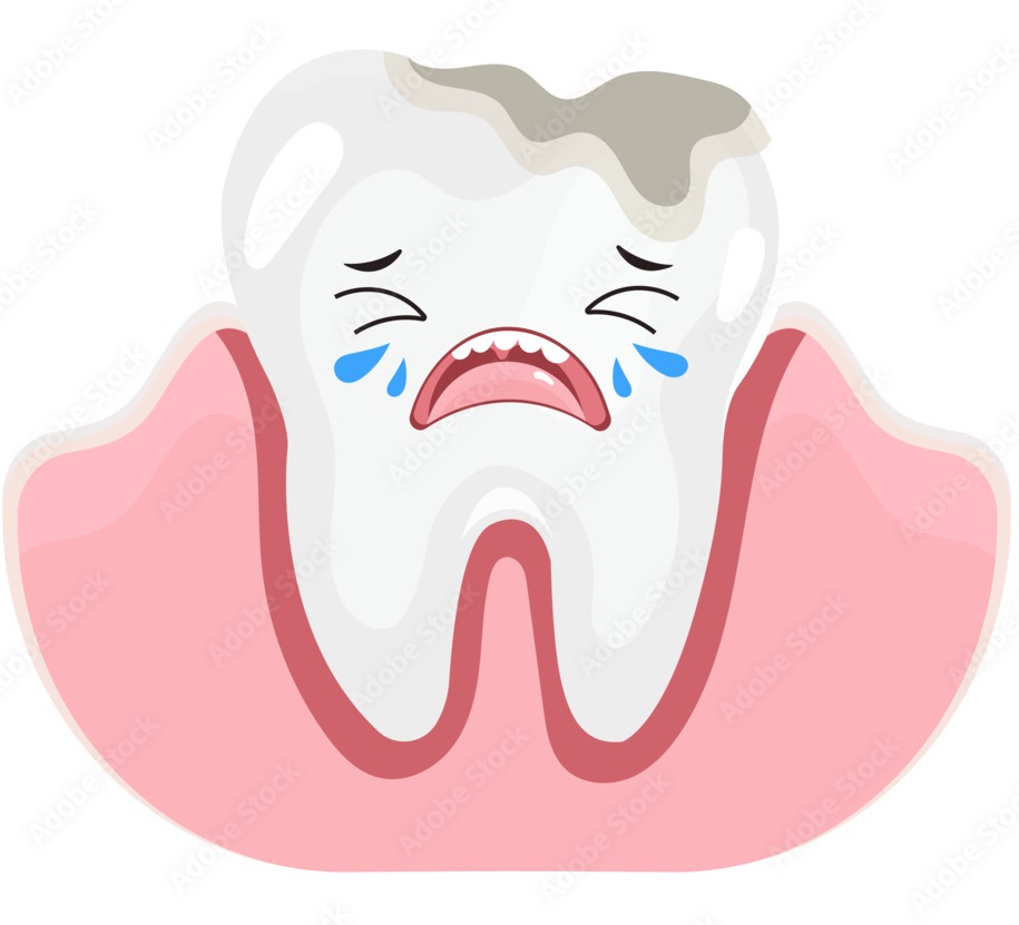 teeth and gums, cavity, gums, gingiva, sensitivity, deposits, plaque and calculus