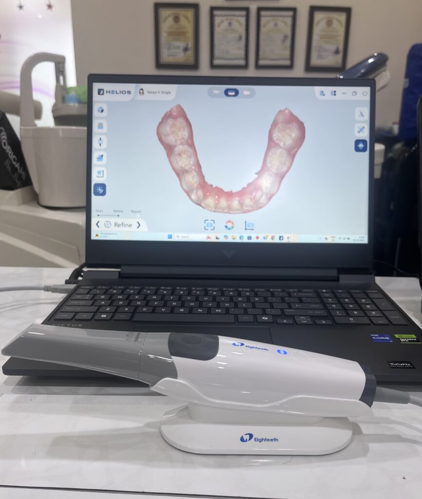 Helios 500 Intraoral Scanner by Eighteeth | Intraoral digital scanner
